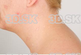 Neck texture of Pat 0008